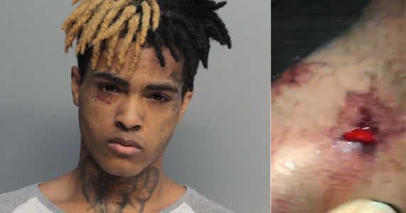 XXXTentacion se fait poignarder par les Migos à LA !