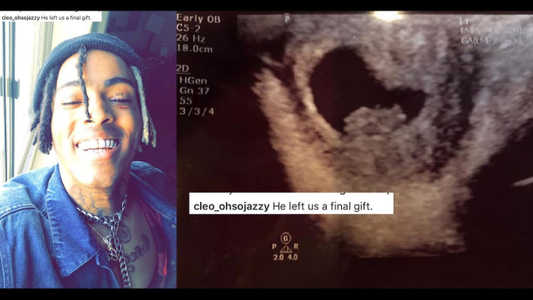 La mère de XXXTentacion annonce que sa petite-amie est enceinte de lui